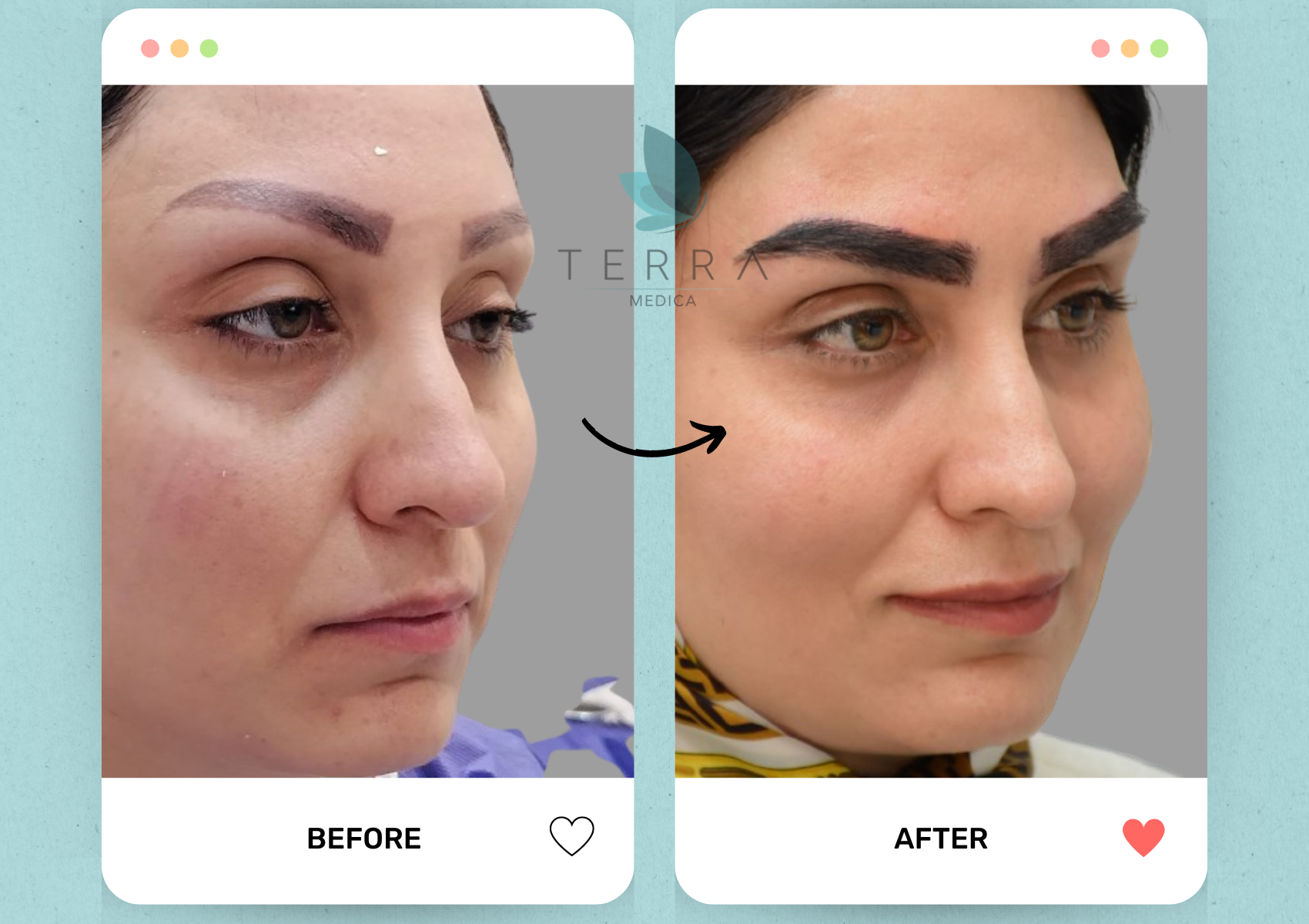 (Abnoos) Select Eyebrow Radiance Treatment