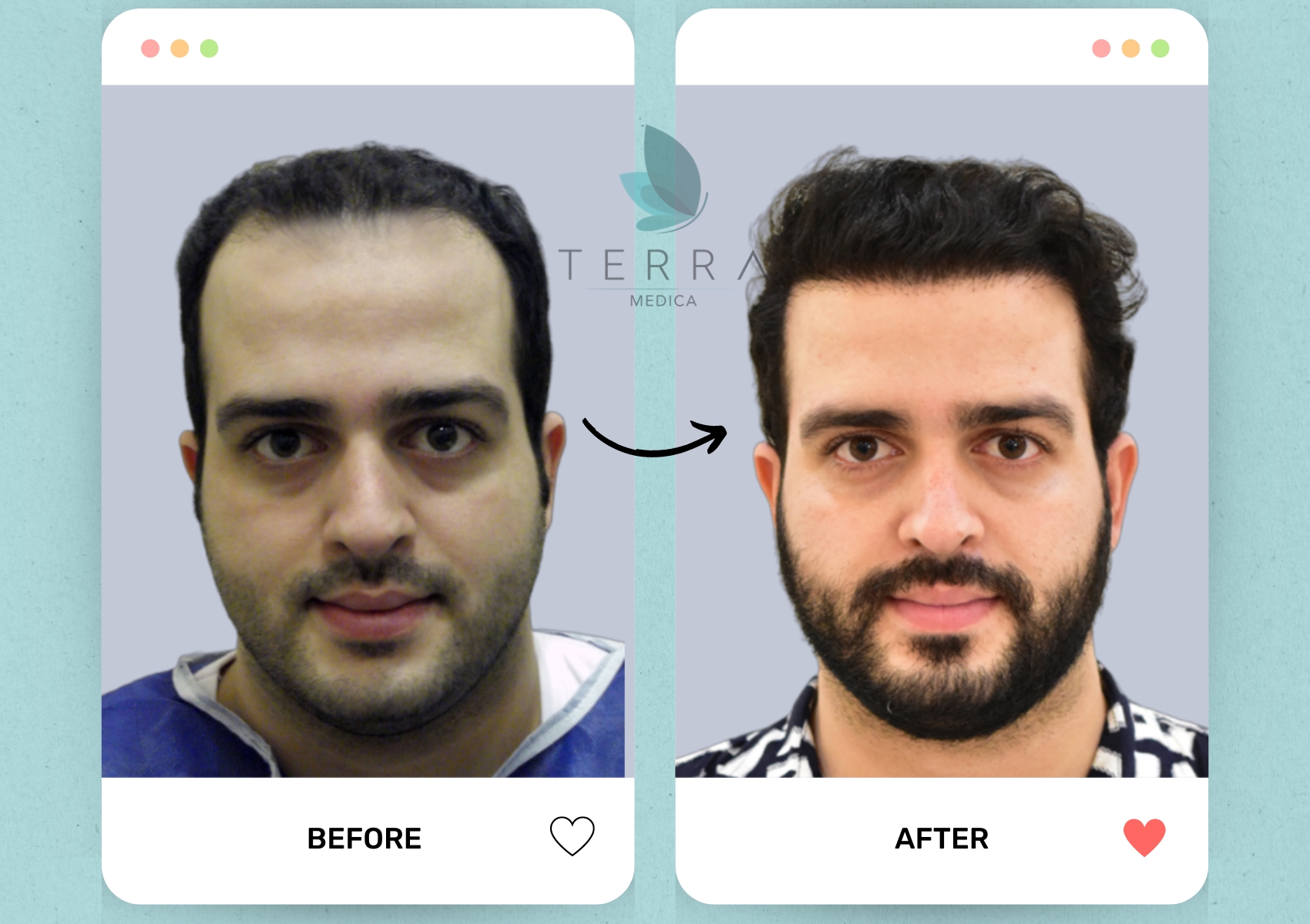 (Abnoos) Select Hair Restoration + Accommodation