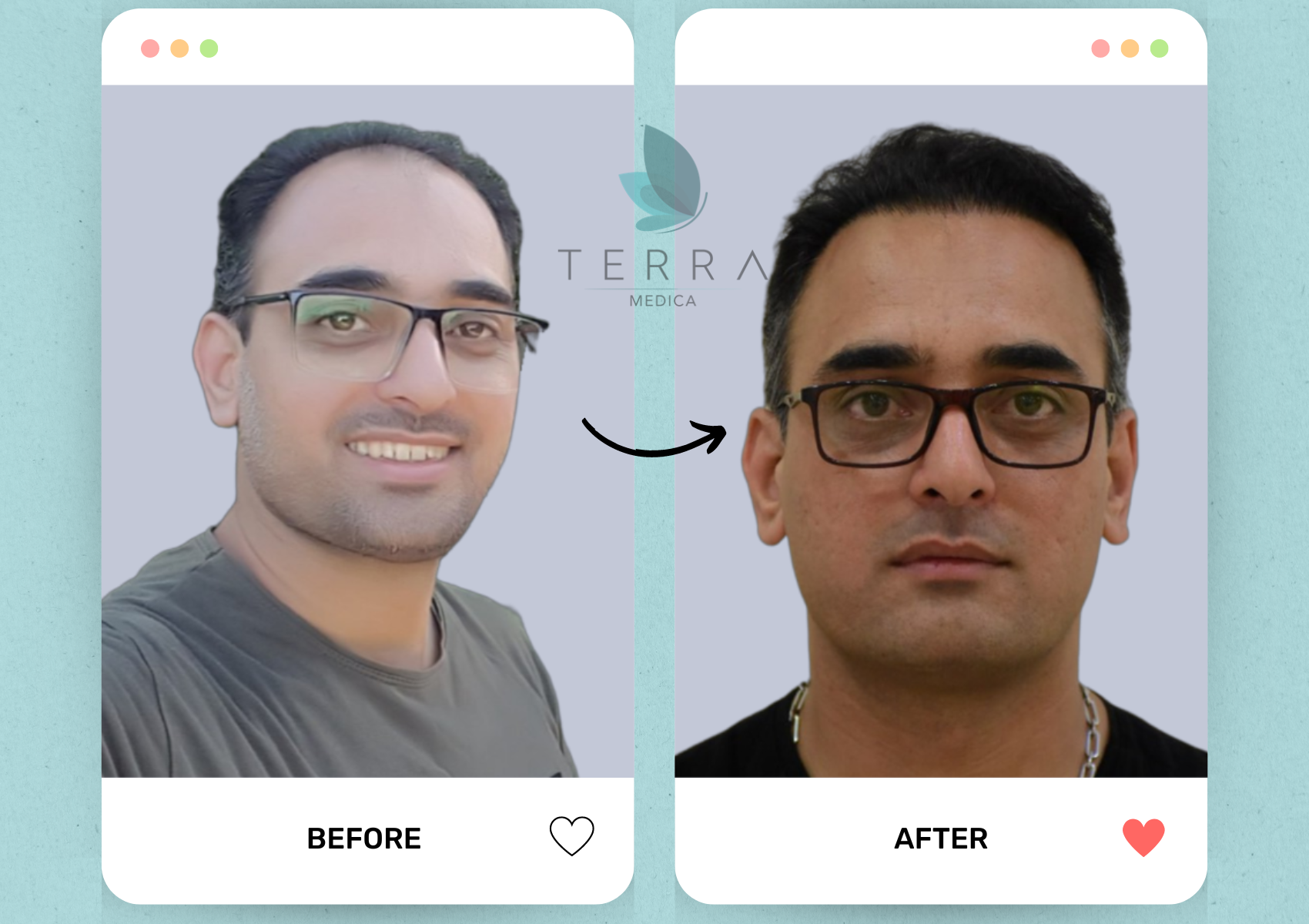 (Abnoos) Select Hair Restoration + Accommodation