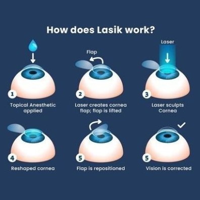 (Dr. Vejdani) Clear Vision LASIK Treatment